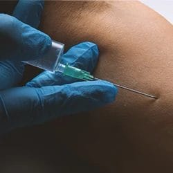 A doctor injecting steroids on a patient